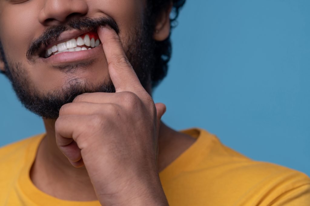 Gum Disease: Causes, Symptoms, and Prevention in Marshville, NC