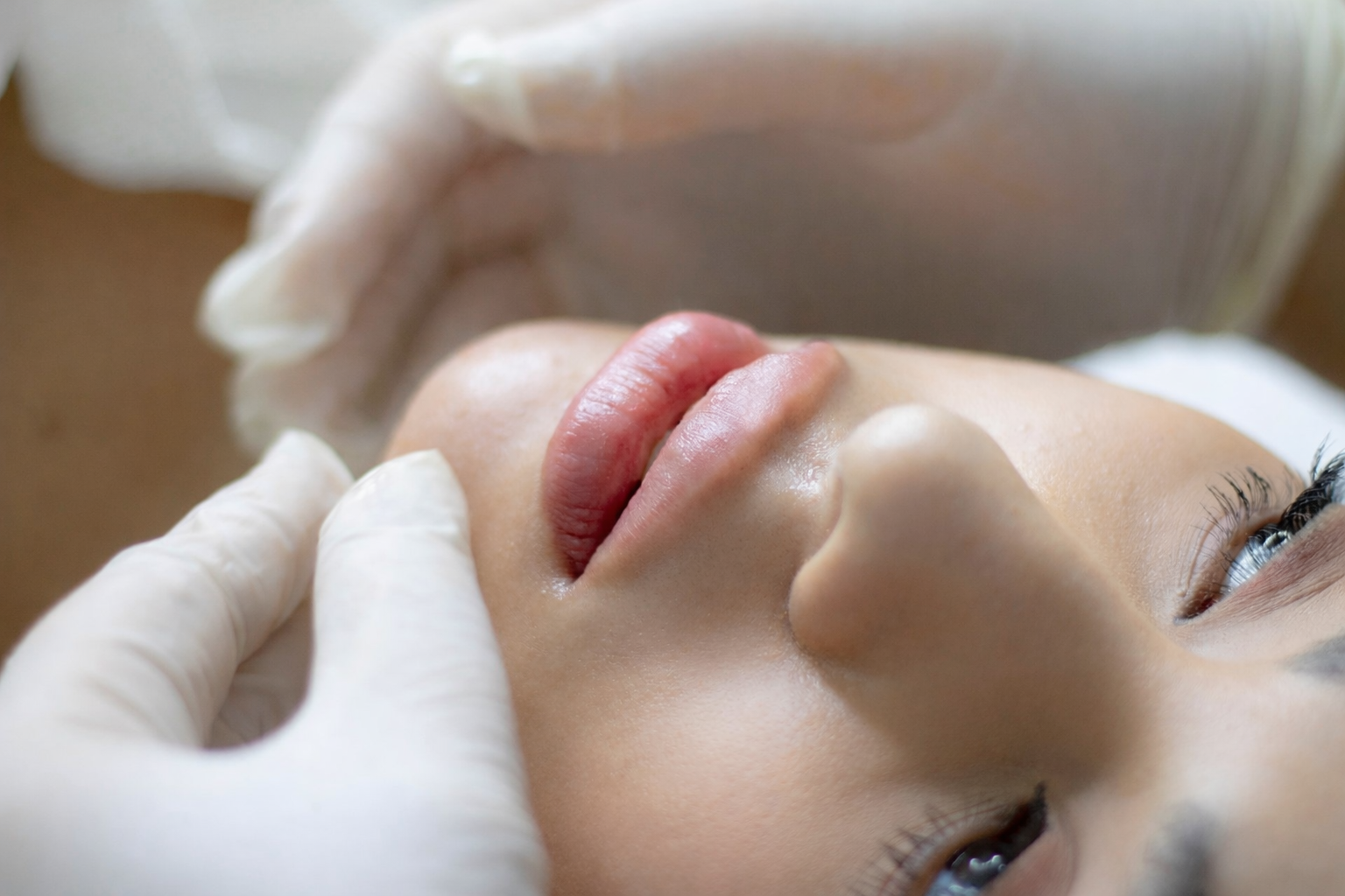 Dermal Fillers in Marshville, NC